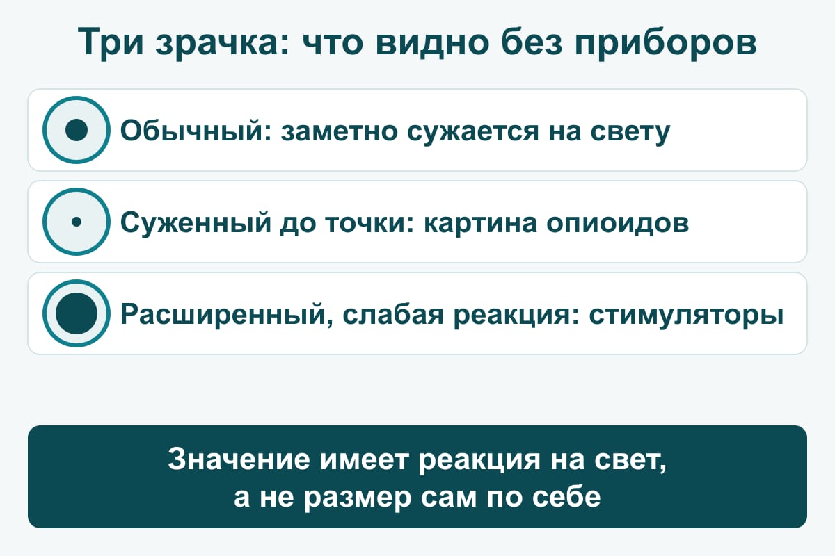 Схема: три зрачка — обычный сужается на свету, суженный до точки характерен для опиоидов, расширенный без реакции — для стимуляторов
